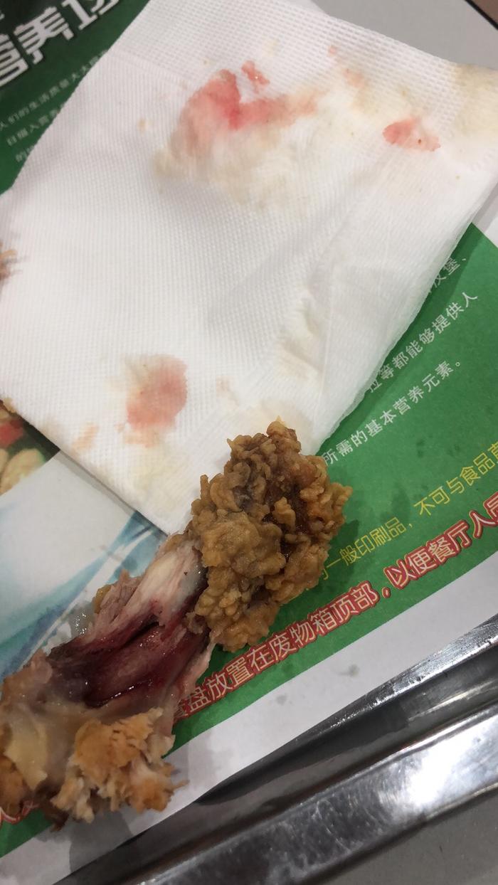 一家炸鸡点炸的鸡腿没熟